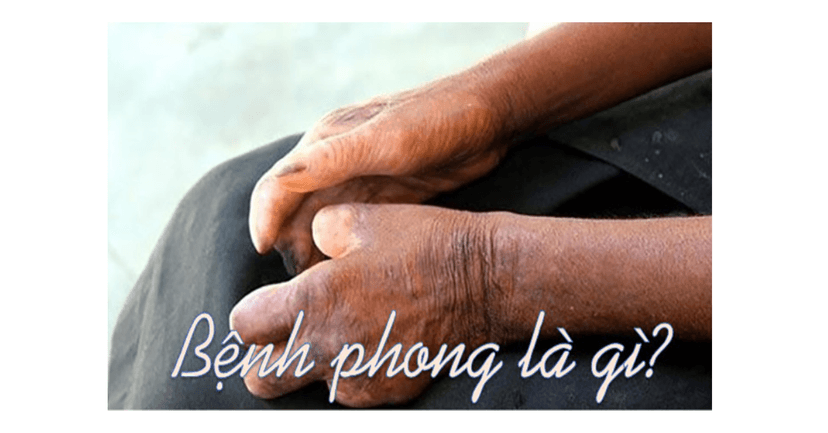 Bệnh Phong Là Gì? Nguyên Nhân, Triệu Chứng, Cách Phòng Ngừa Và Điều Trị
