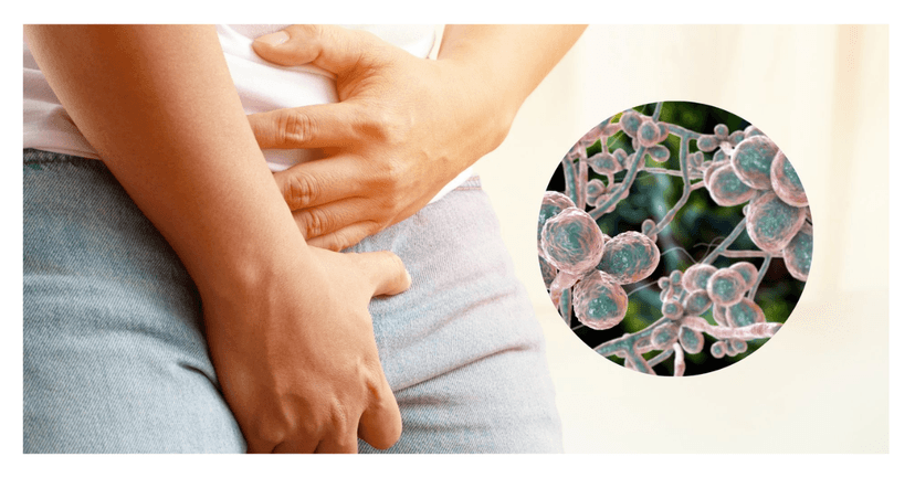 Nấm Sinh Dục Là Gì? Triệu Chứng, Nguyên Nhân, Cách Phòng Và Điều Trị