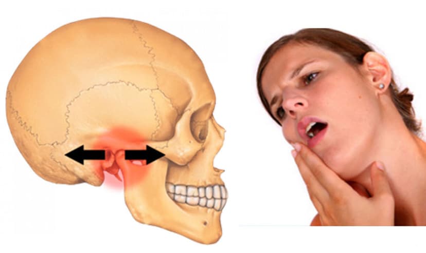 Viêm Khớp Thái Dương Hàm: Dấu hiệu, nguyên nhân Và phương pháp điều trị