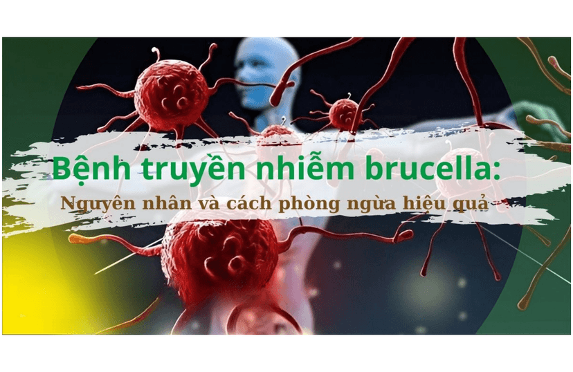 Bệnh Brucella: Nguy cơ tiềm ẩn và cách phòng tránh