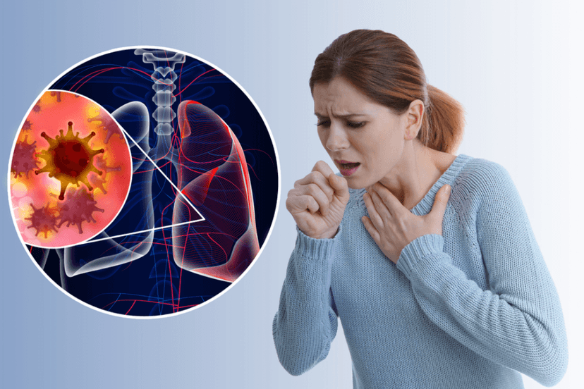 Viêm phổi: Biểu hiện, nguyên nhân, chẩn đoán và điều trị