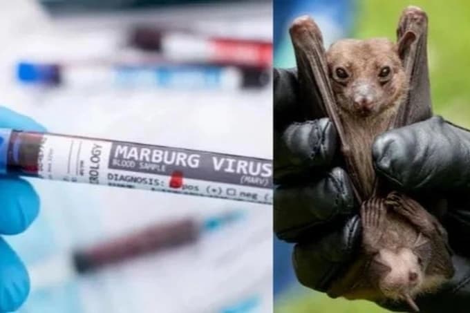 Bệnh do virus Marburg: Hiểu rõ về nguy cơ và cách phòng tránh