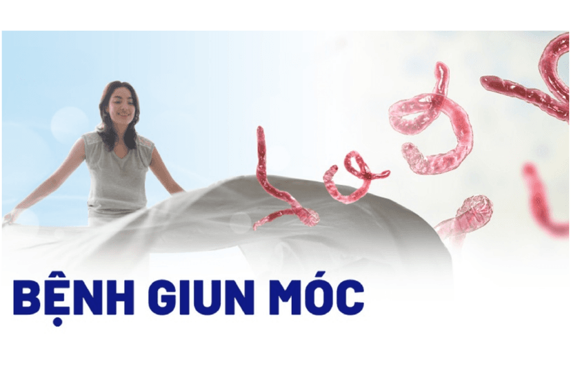 Nhiễm giun móc: Triệu chứng, nguyên nhân và cách điều trị hiệu quả