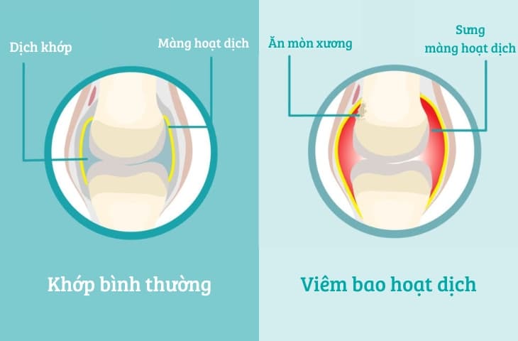 Cơ xương khớp